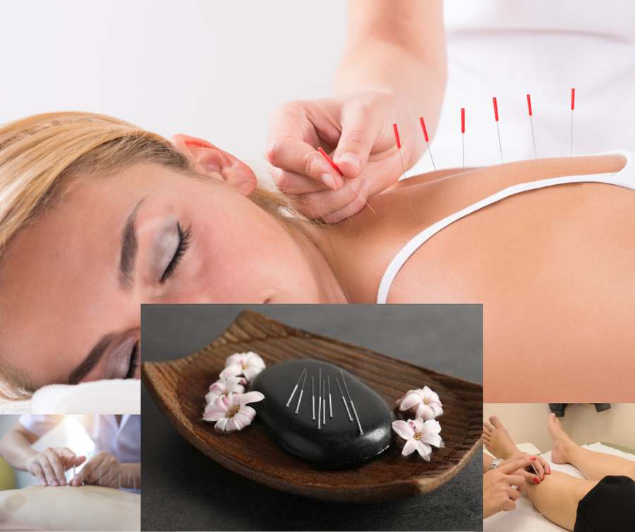 R.A. Acupuncture — Acupuncture in N Northwest Hwy #319a, Chicago