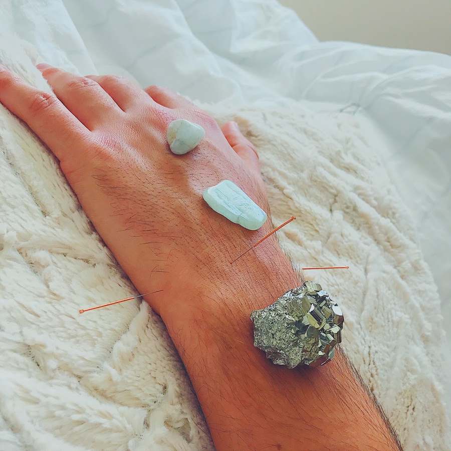 Aurapuncture — Acupuncture in 11th St Ste 113, Miami