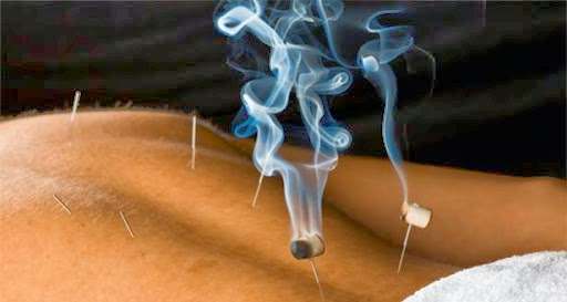 Blue Serenity Acupuncture — Acupuncture in E Bell Rd Ste 45427, Phoenix
