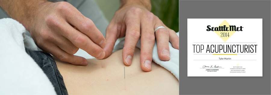 Fit Acupuncture — Acupuncture in Barnes Ave NW, Seattle