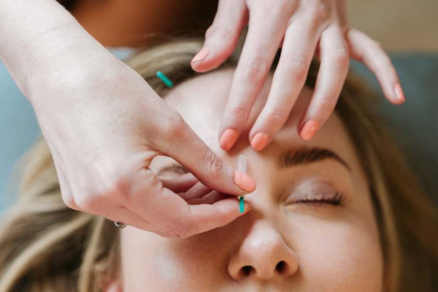Sacred Healing Acupuncture — photo 1