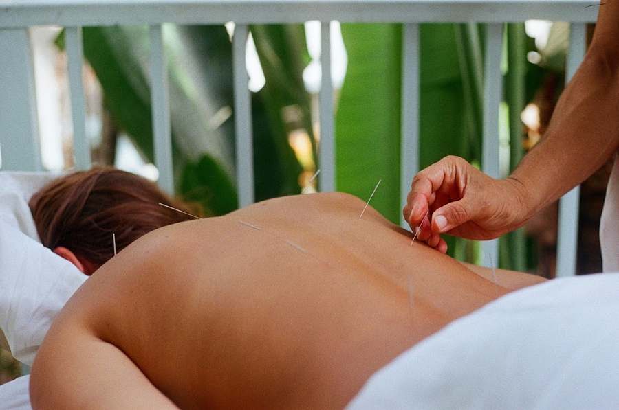 Acupuncture By Mia — photo 1
