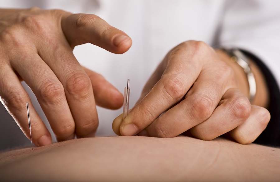 ACA Acupuncture & Wellness - Bayside — photo 1