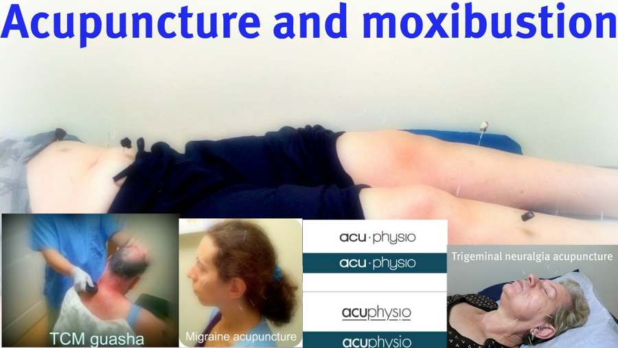 Acuphysio Acupuncture and Physical Therapy — photo 1