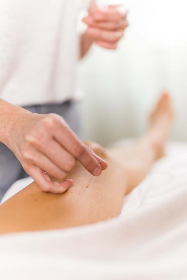 ArTeva Acupuncture — photo 1