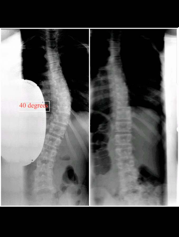 New York Chiropractic & Scoliosis Center — photo 1