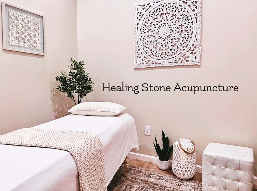 Healing Stone Acupuncture — photo 1