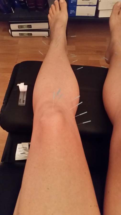 Solutions Acupuncture & Naturopathic Medicine, PLLC — photo 1