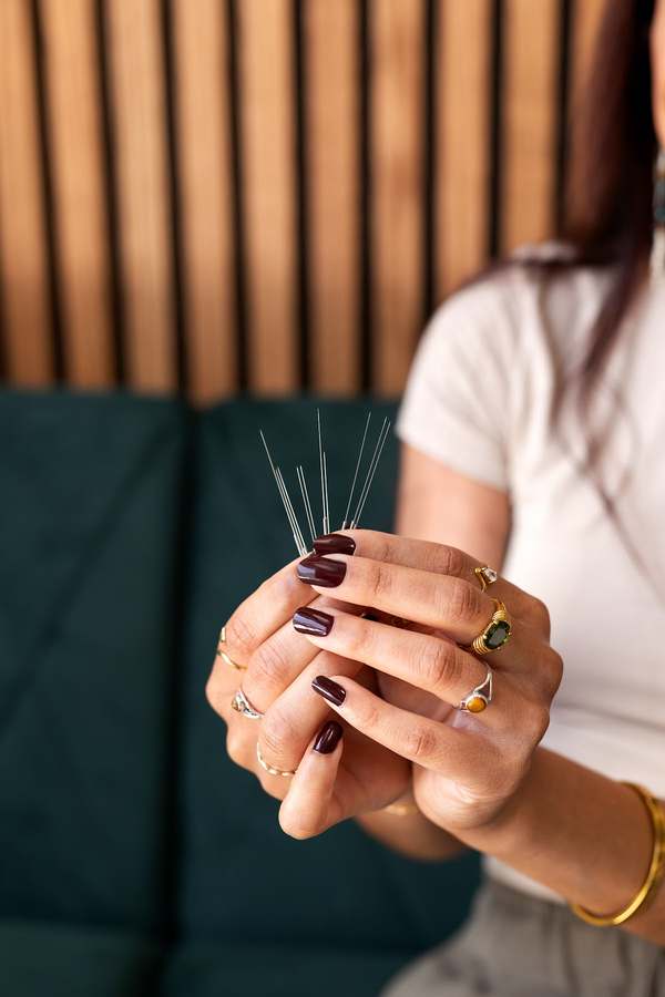 Auna Acupuncture and Wellness — photo 1